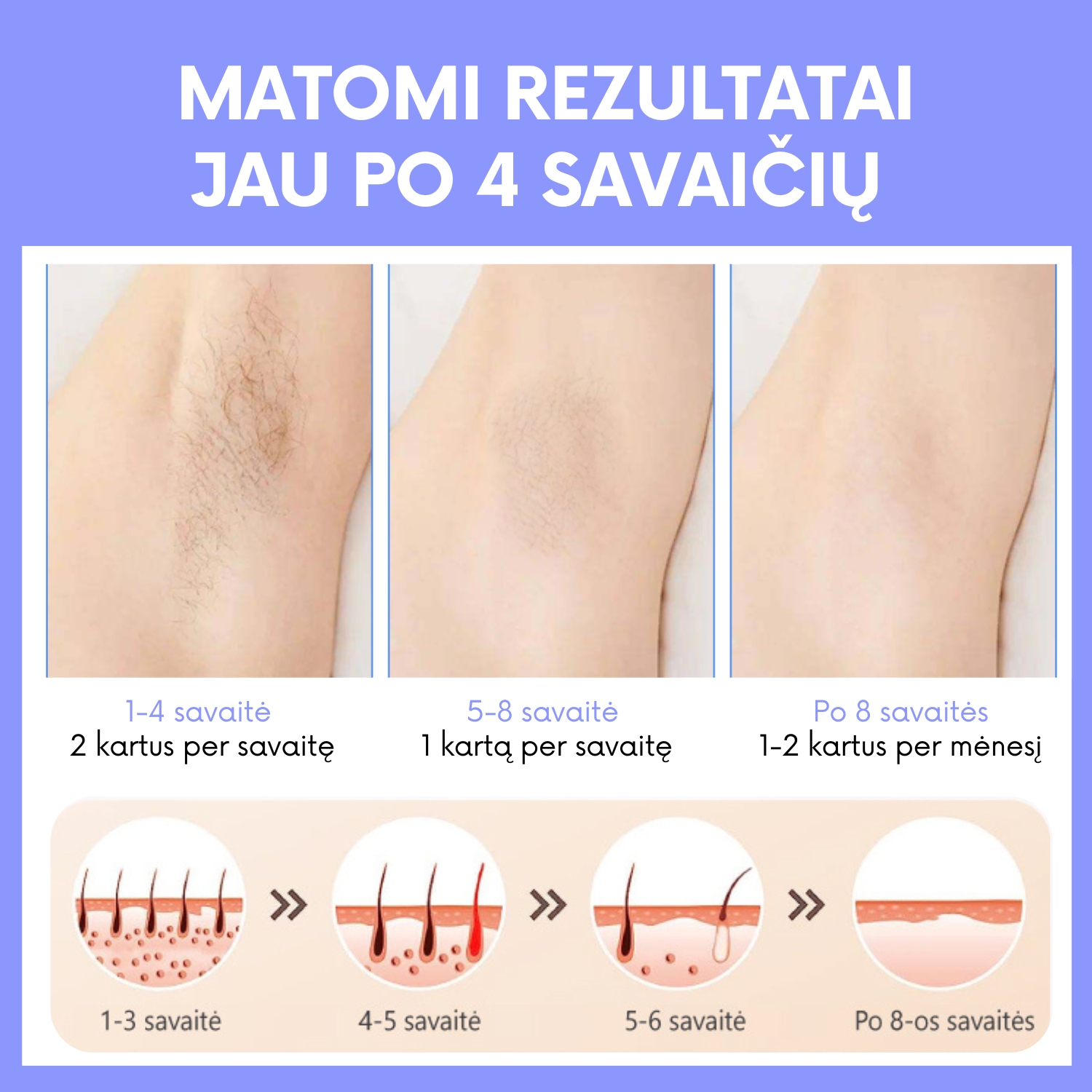 MATOMI REZULTATAI JAU PO 4 SAVAIČIŲ su fit2 fotoepiliatoriumi